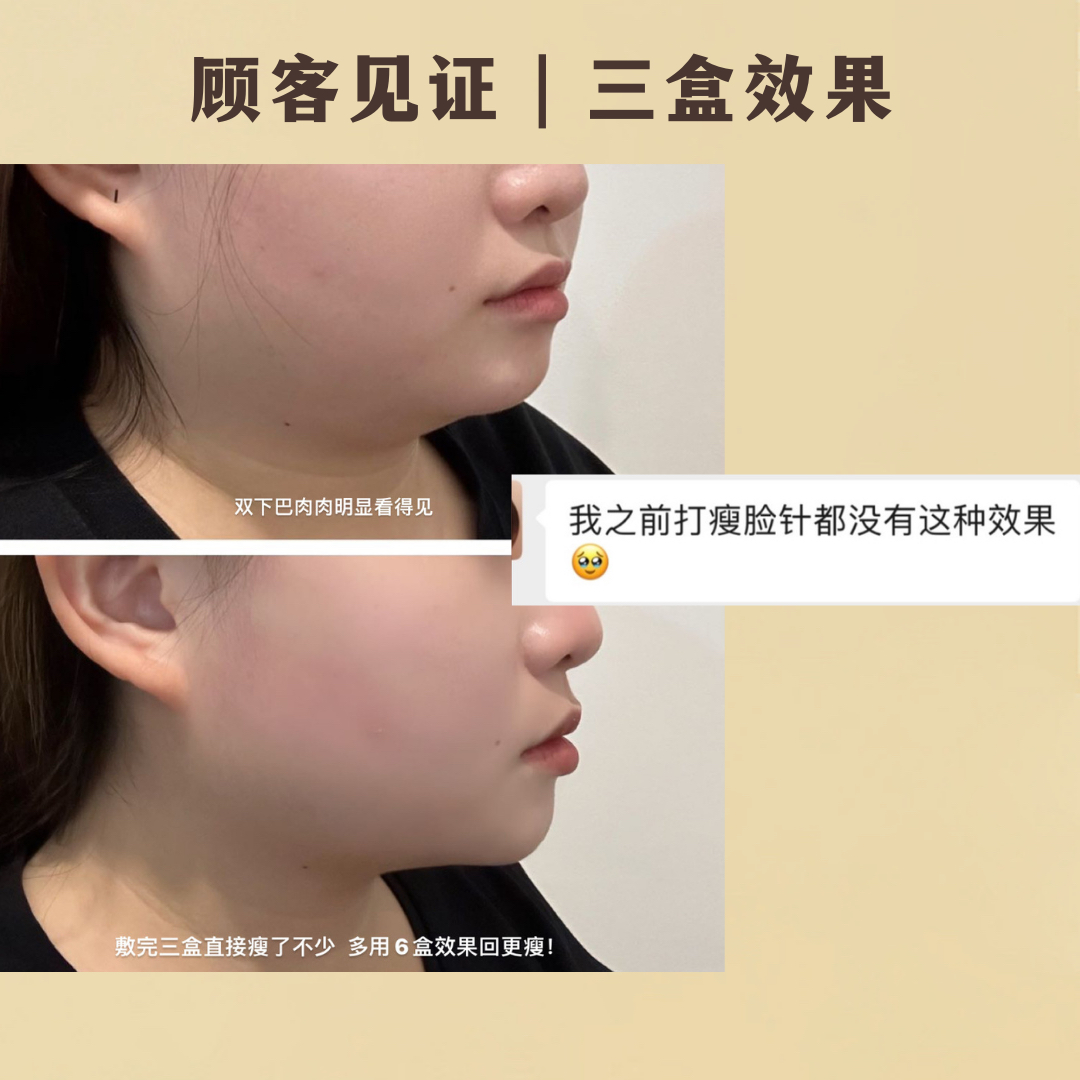 REVERIE瘦脸面膜-热销款