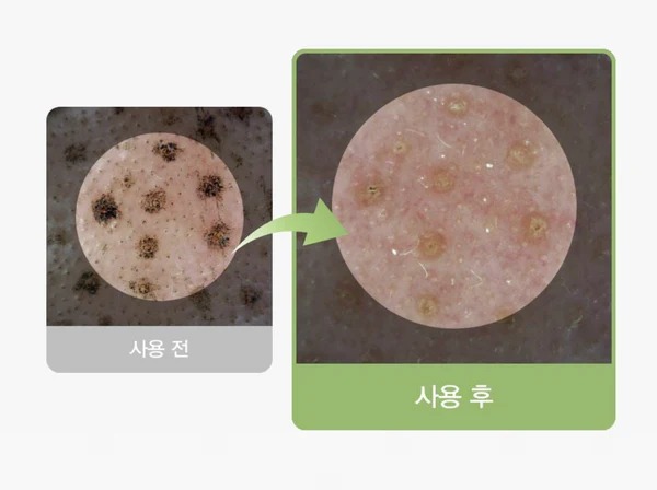 ABIB -  收毛孔潔淨泥面膜潔面乳