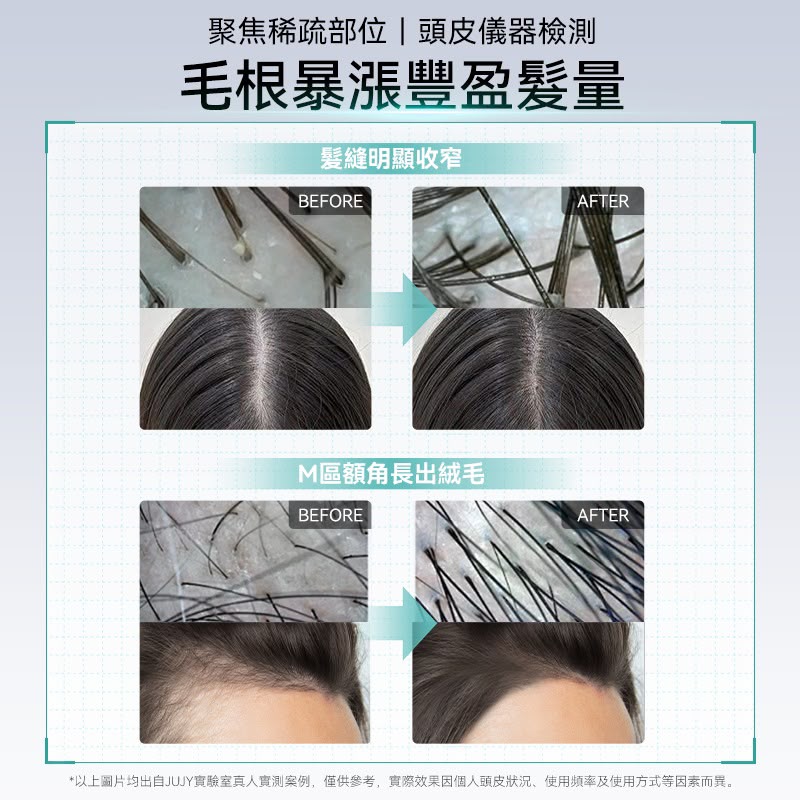 日本🇯🇵JUJY 3D仿人手多點抓揉按摩低頻EMS三色光能滾珠導液密髮增髮梳Pro