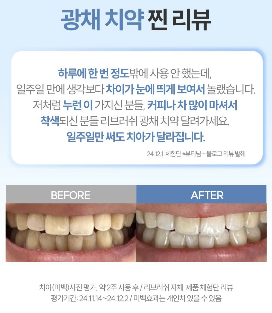 韓國 Re:Brush 美白光澤牙膏 + 精華劑 套裝｜ReBrush Teeth Whitening Toothpaste Brightening Intense