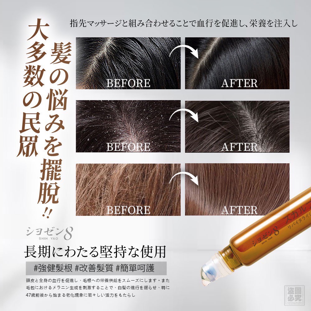 日本 シヨゼン8 頭皮煥活精華調理滾珠 20ml