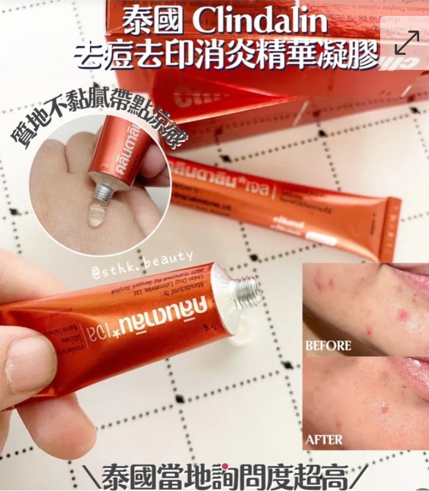 $45支.2支以上$35支.泰國 暗瘡膏 Clindalin gel 5g