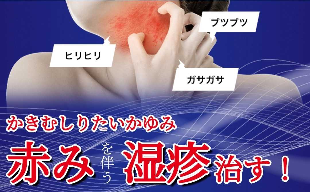 日本曼秀雷敦Medi Quick PRO濕疹治療膏 8g 清爽乳霜型 