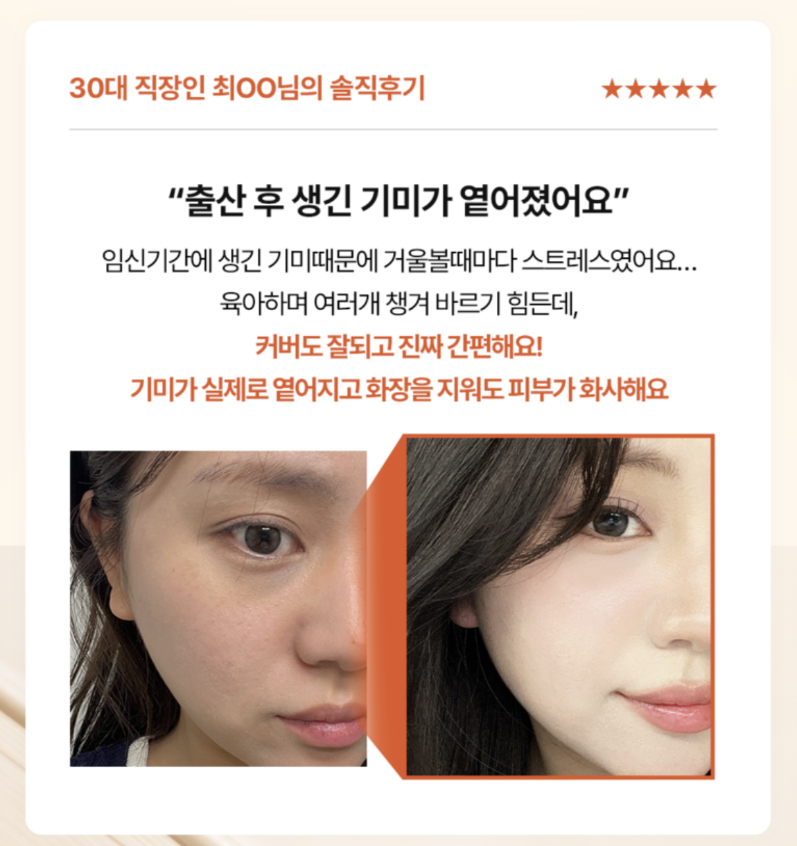 韓國 Mommy Care Orthotamin 醫學級 高純度 純維C防曬亮膚 氣墊｜Vitamin C Ampoule Cushion