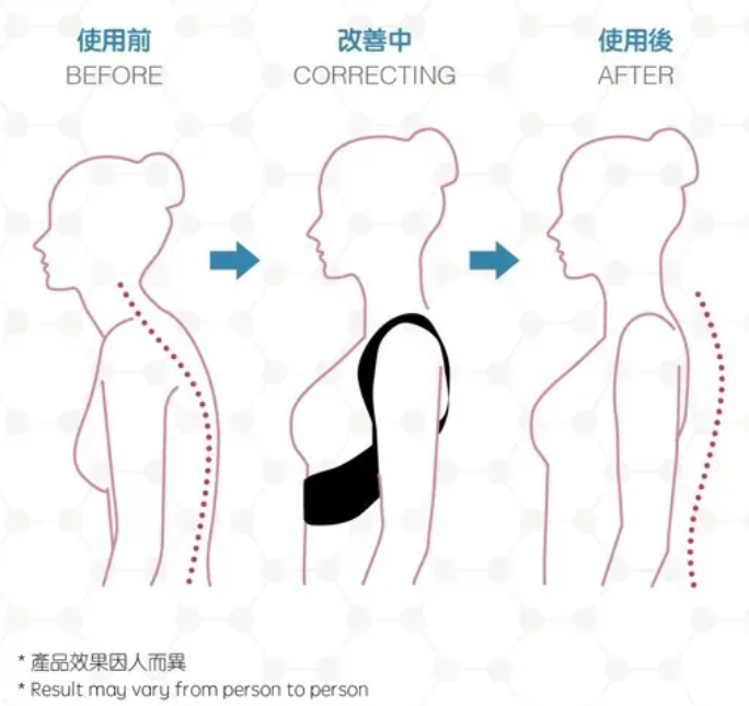 【優舒保】 負離子矯型馬甲