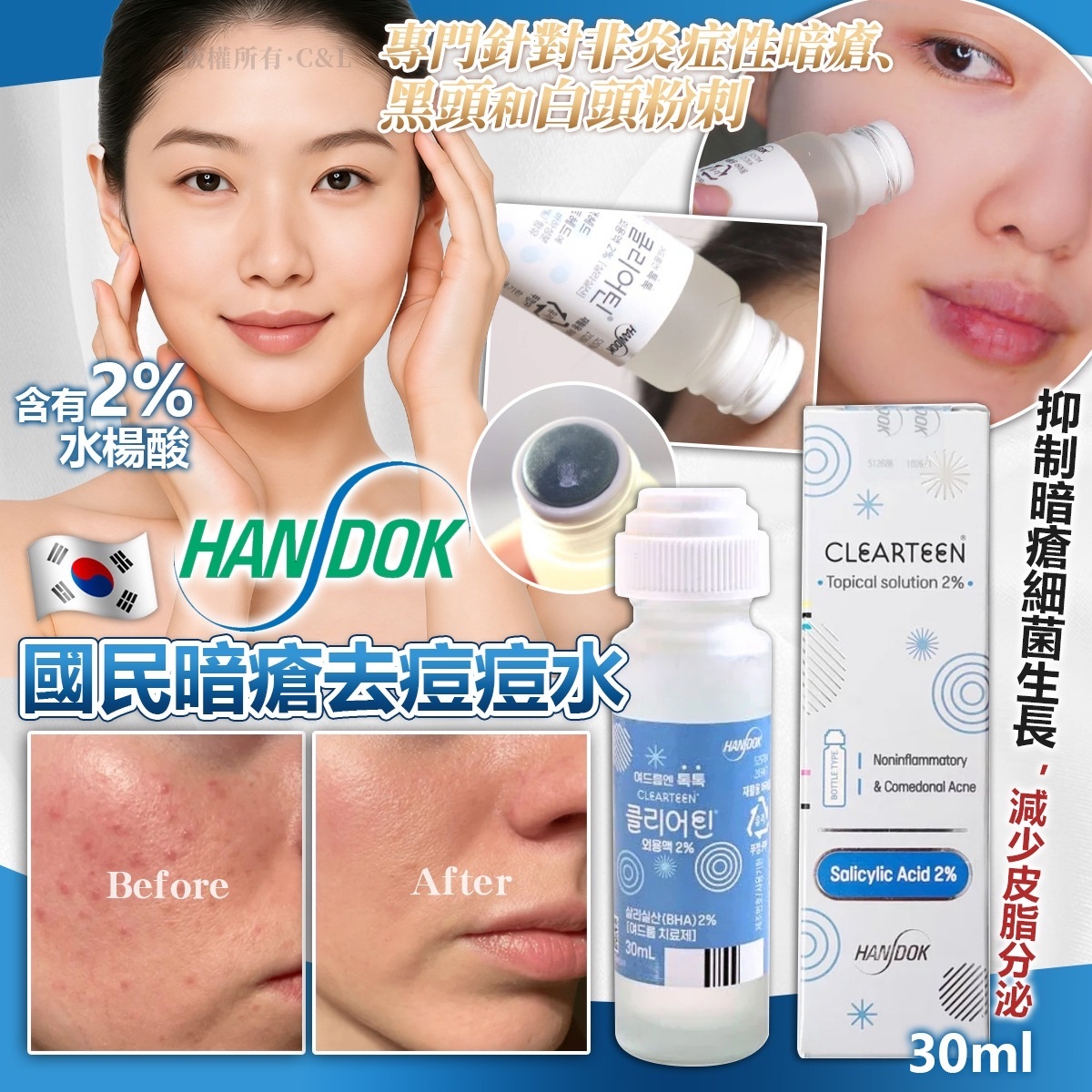 韓國 Handok 國民暗瘡去痘痘水 30ml