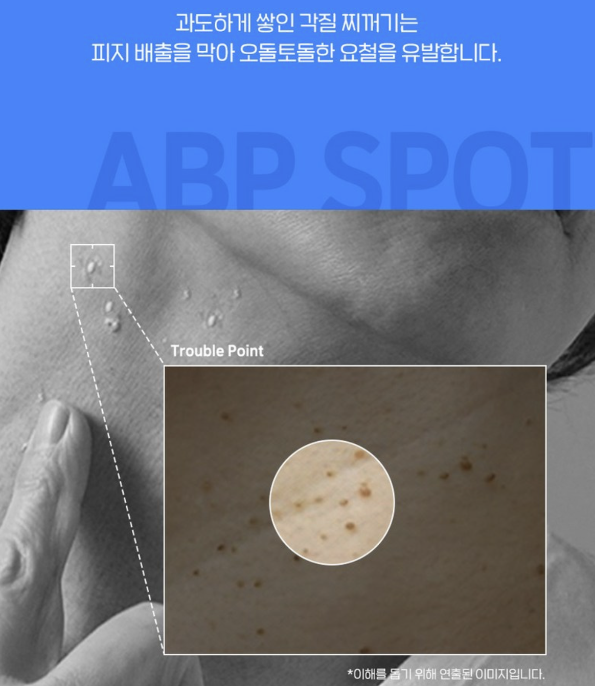 韓國藥局 Dr.Deep ABP 醫美級 脂肪粒 局部煥膚 點點霜 20ml ｜ABP Spot Cream