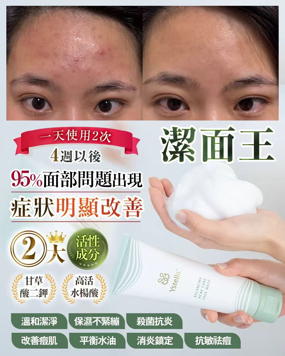 Ystella潔面王 - 03260005