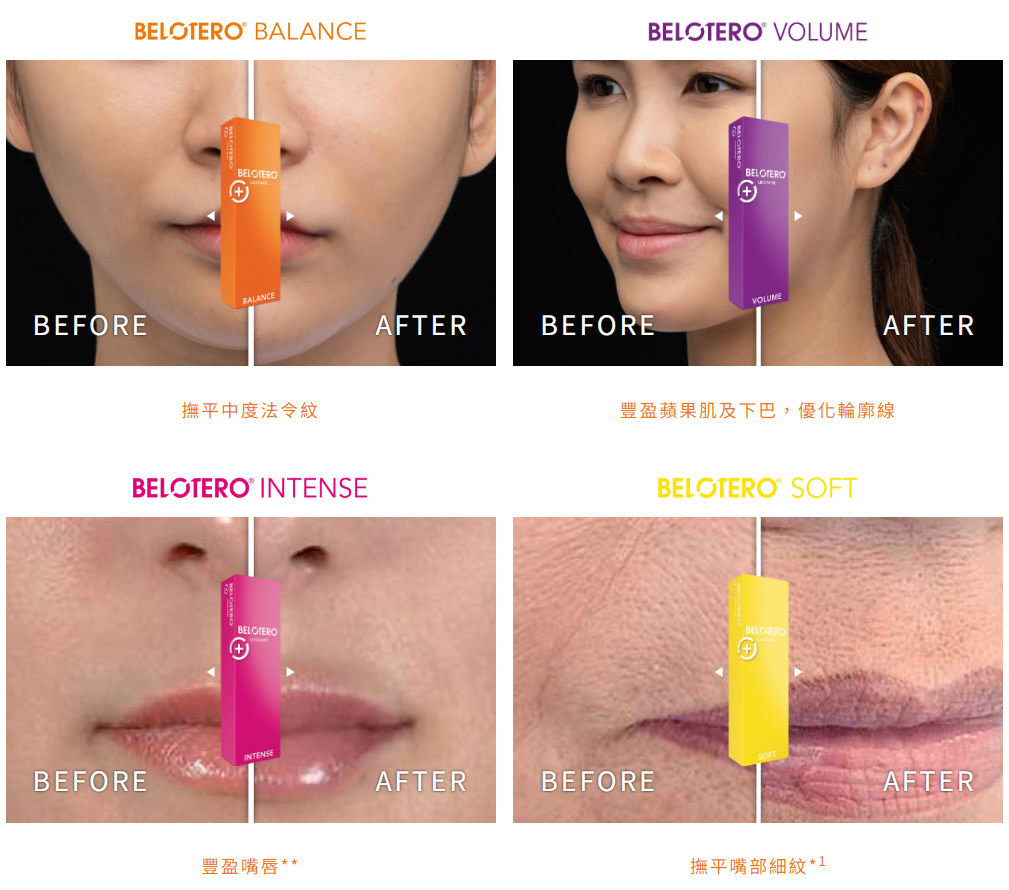 【Infinite Medical】BELOTERO® 系列透明質酸🌈彩虹針