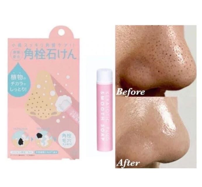 COGIT 鼻頭粉刺酵素清潔棒 8G - 1件 - 現貨