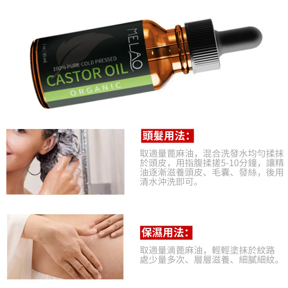 MELAO 蓖麻油頭髮護理油 頭皮護理 按摩精油 修復受損 滋養毛囊 修護頭皮 30ml [平行進口] HK2672