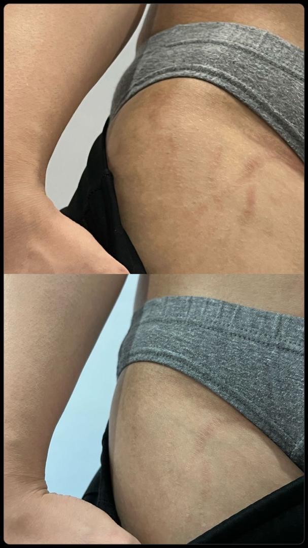 🇲🇾 10 盒 最畅销 VVIP 疗程配套（ 可服用 60-75天 ）