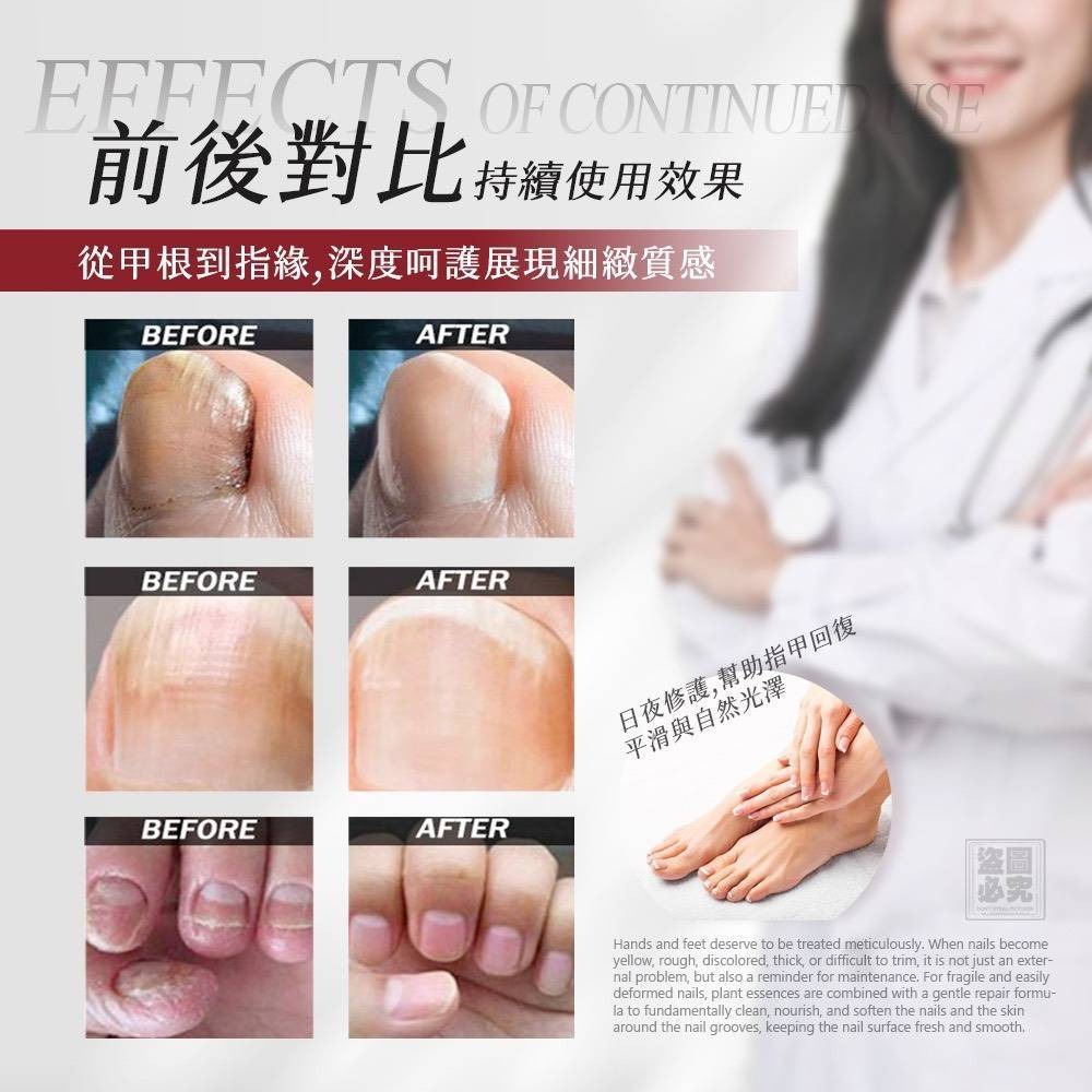 台灣生醫廠 灰指甲滋養膏15ml