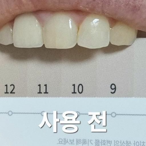 韓國 Re:Brush 美白玻璃牙膏+精華液組｜ReBrush 牙齒美白牙膏亮白強效