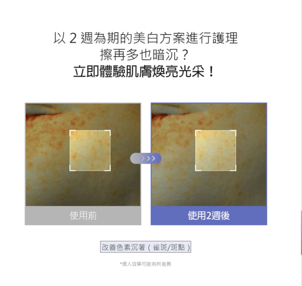 現貨💜 SAM'U穀胱甘肽彈潤亮白安瓶 SAM'U穀胱甘肽彈潤亮白精華 SAM'U美白精華 SAM'U穀胱甘肽精華 GLUTAMIDE SHOT 亮白淡斑 美白淡斑 淡斑精華 😃 韓國 日本 💜